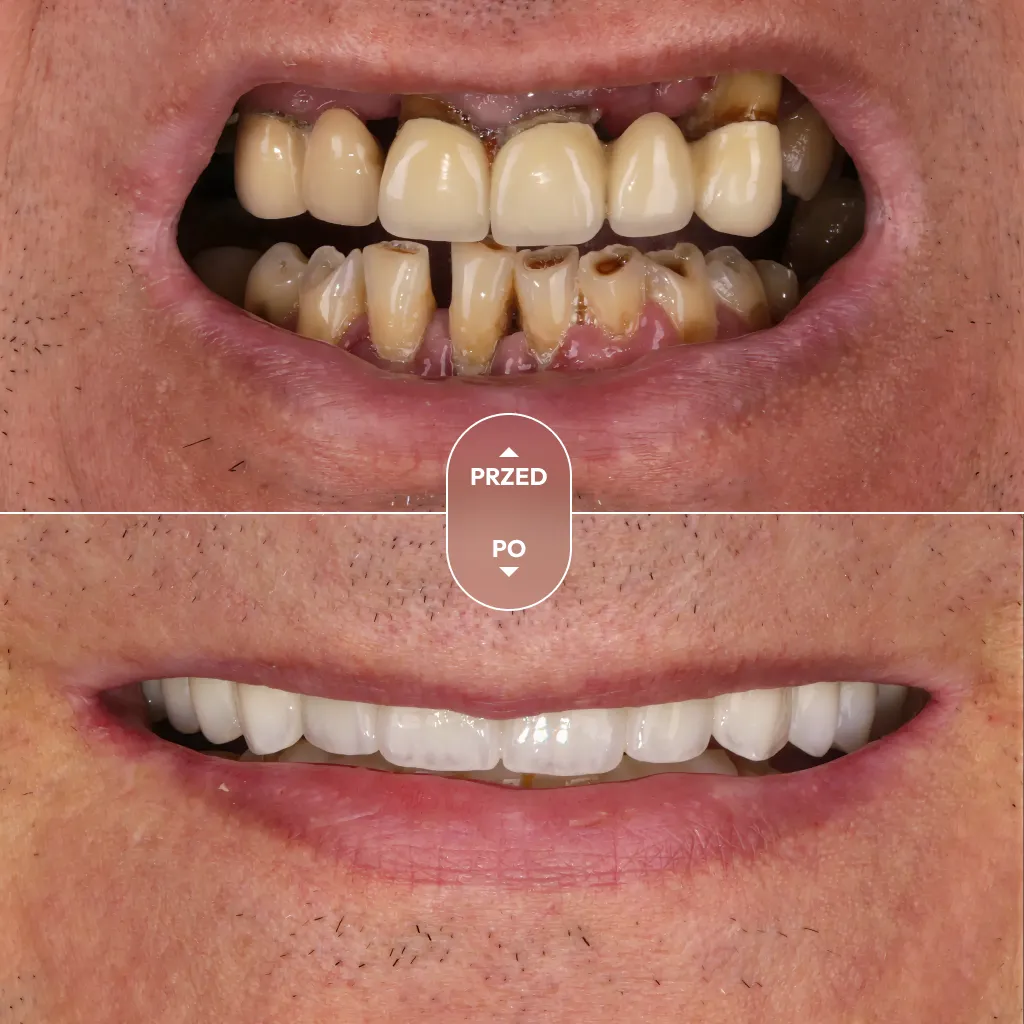 dr-piotrowska-metamorfoza-01