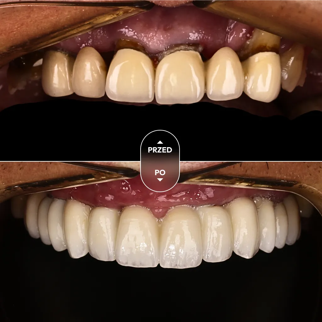 dr-piotrowska-metamorfoza-02