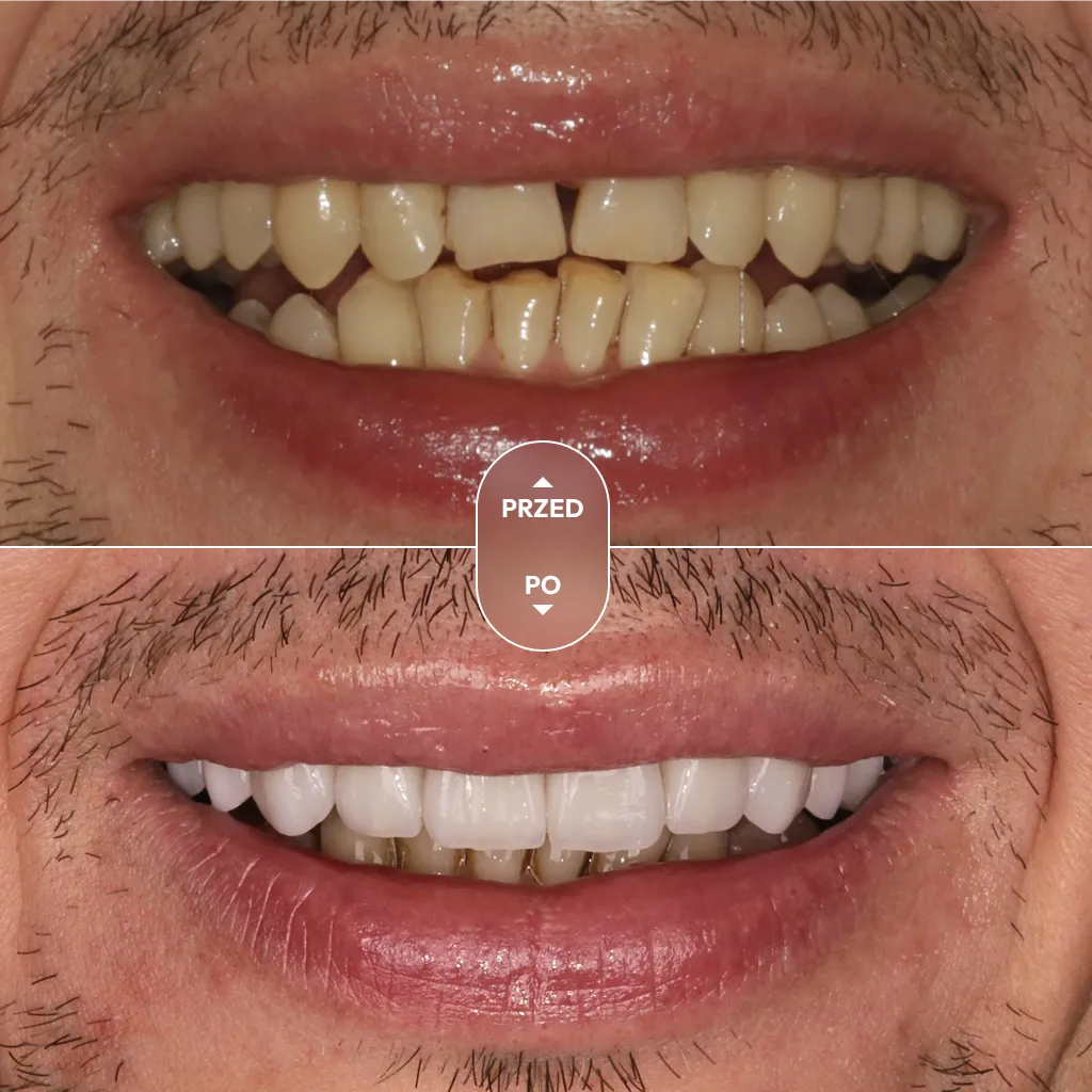 dr-piotrowska-metamorfoza-03