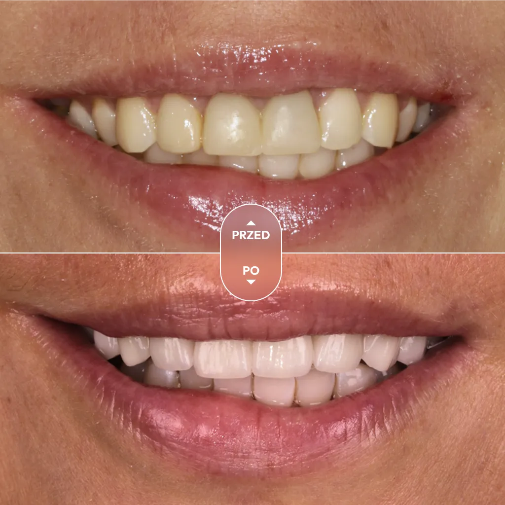 dr-piotrowska-metamorfoza-04