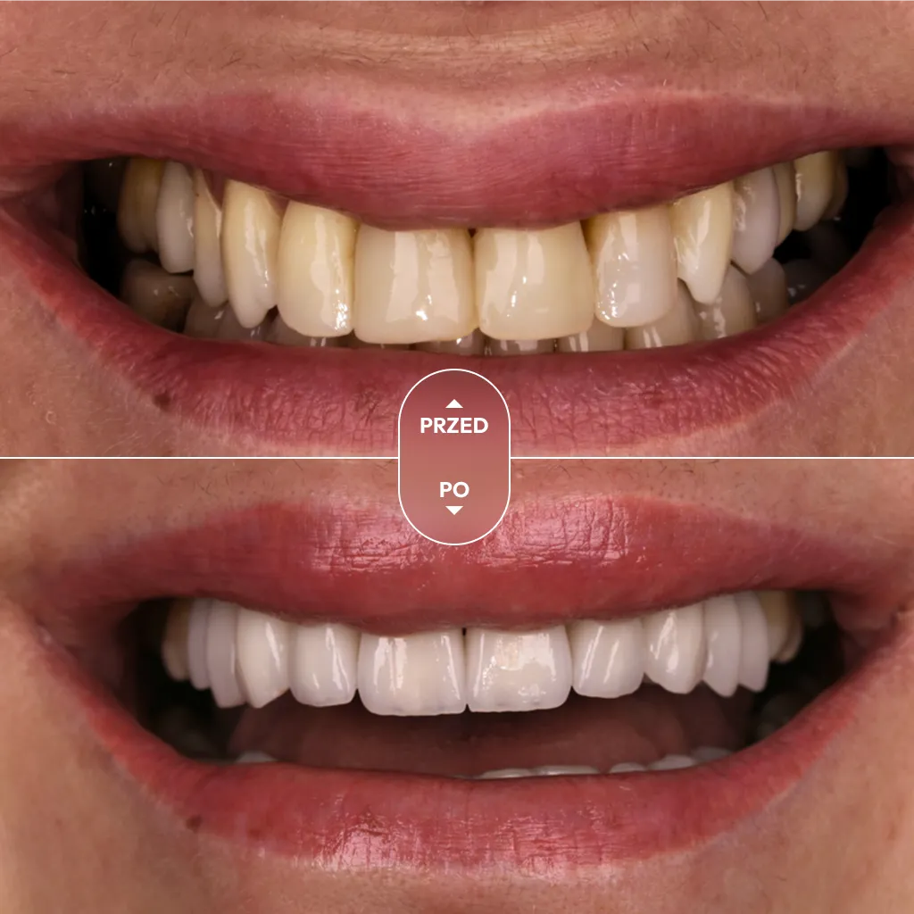 dr-piotrowska-metamorfoza-05