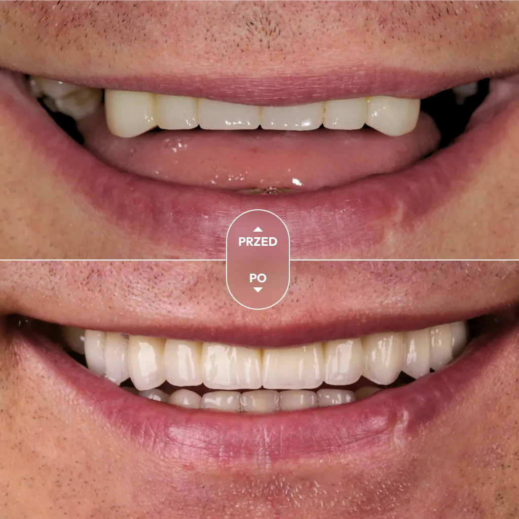 dr-piotrowska-metamorfoza-06