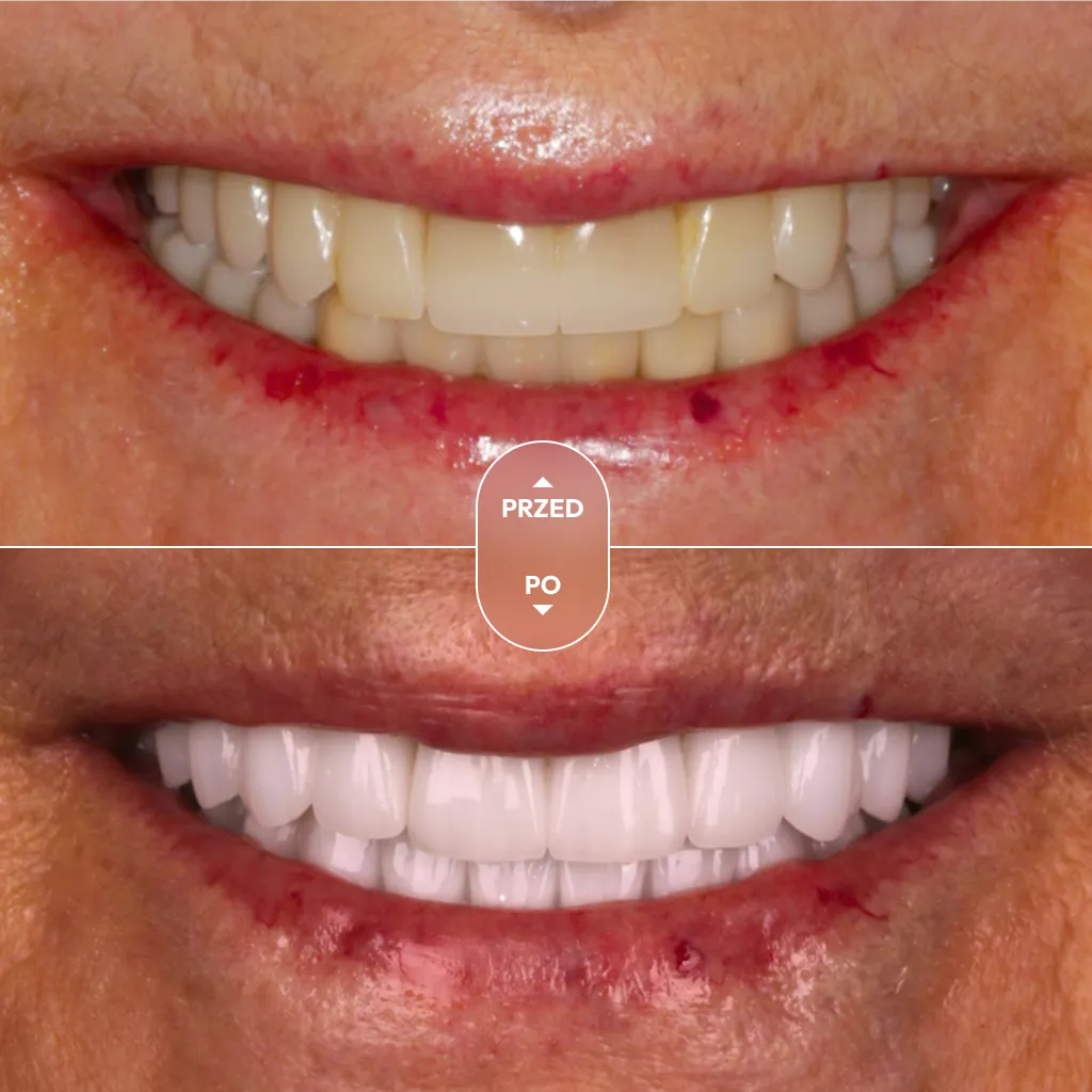 dr-piotrowska-metamorfoza-07