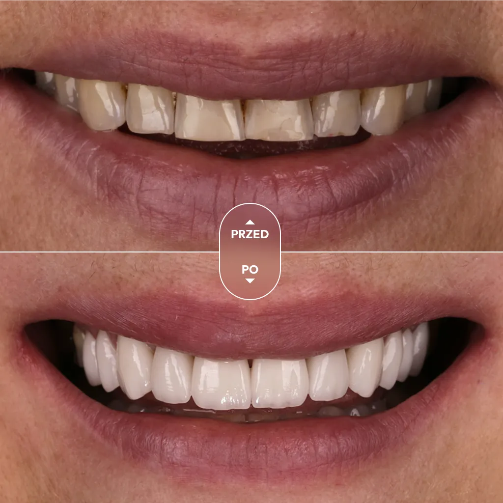 dr-piotrowska-metamorfoza-08