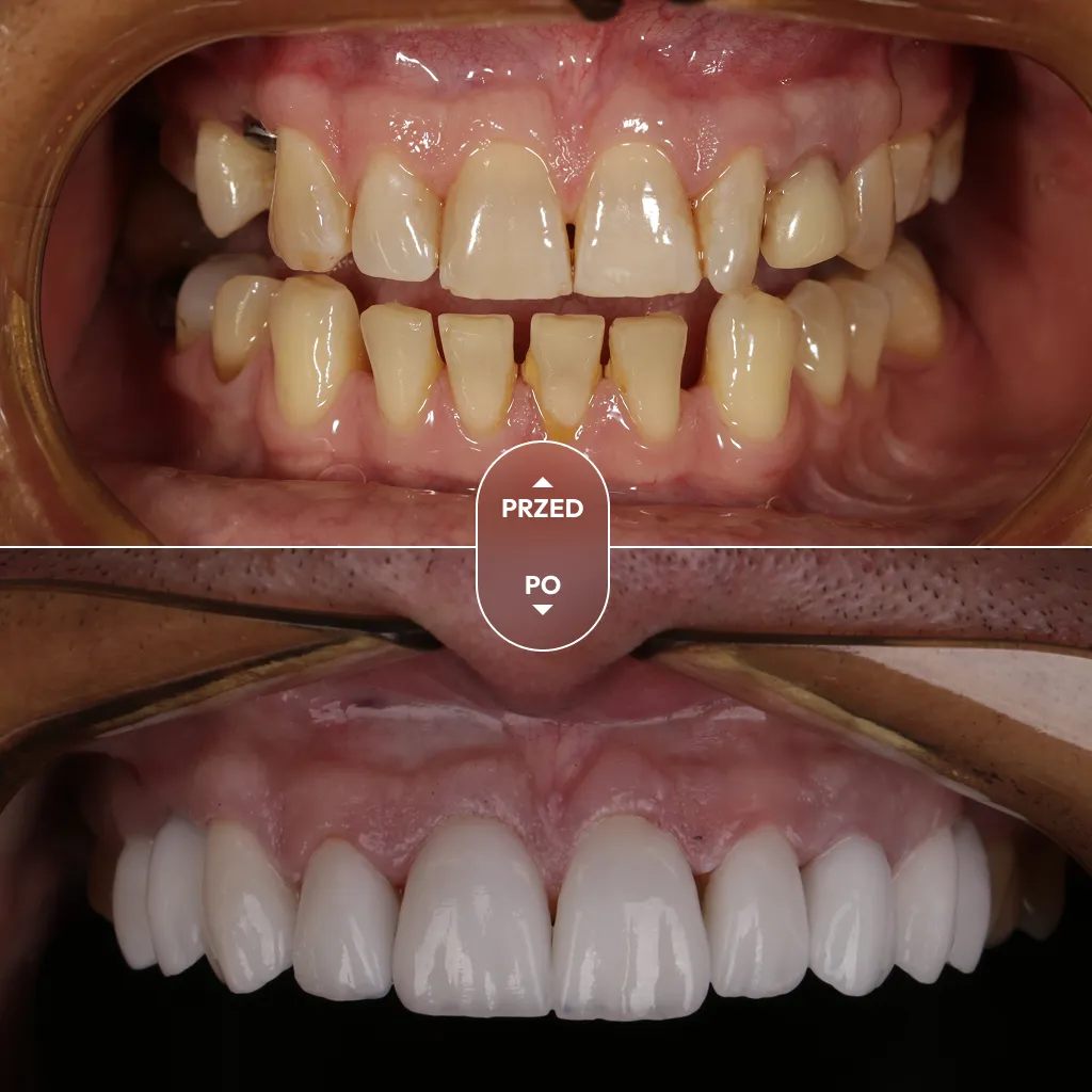dr-piotrowska-metamorfoza-09