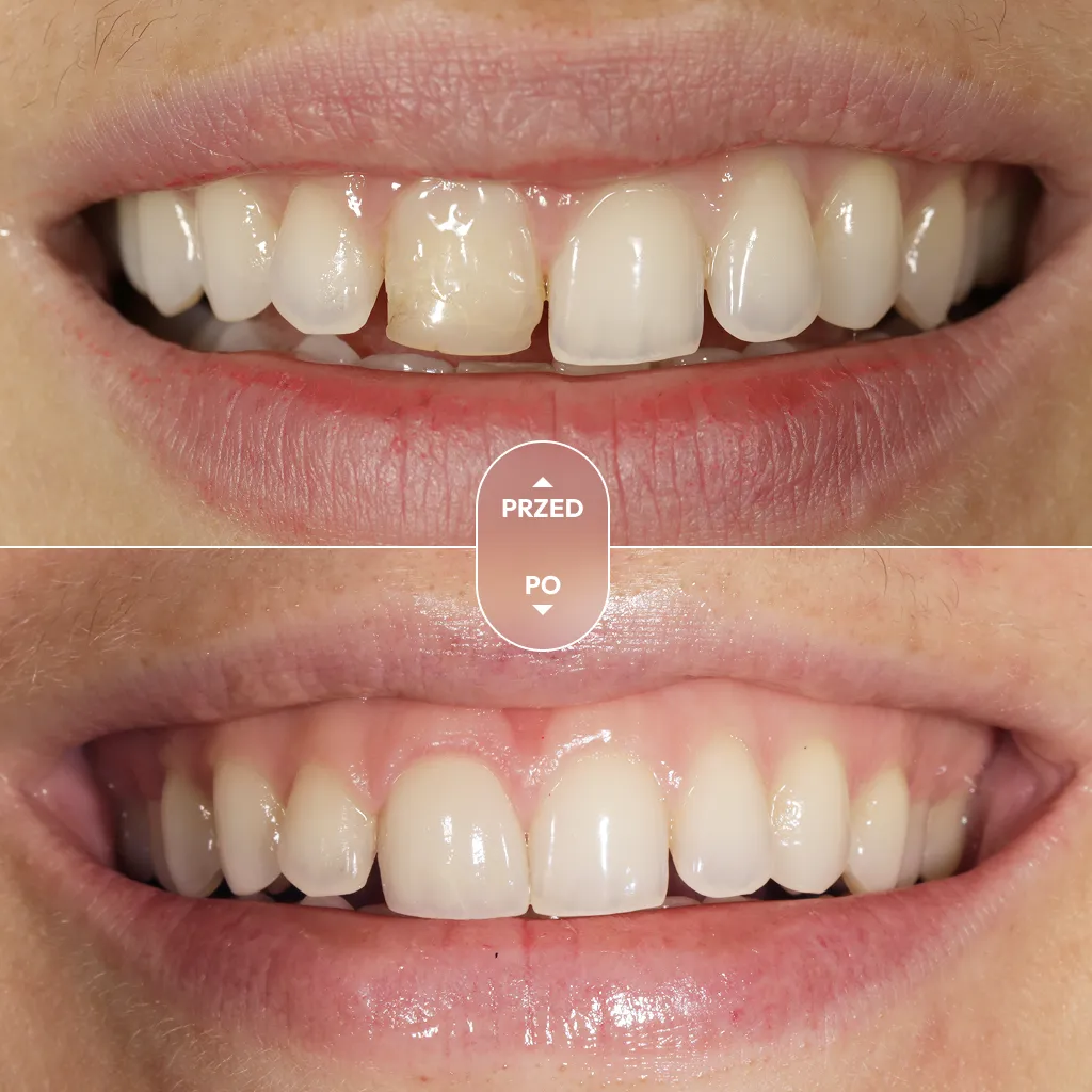 dr-piotrowska-metamorfoza-10